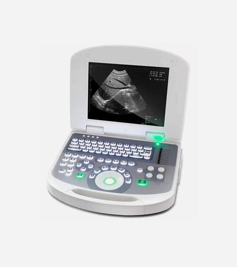 Glow Chemist - Portable Ultrasound Scanner